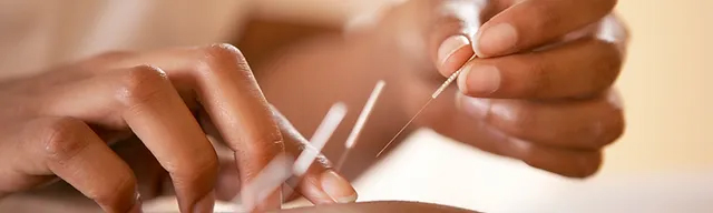 acupuncture-benefits-chinese-medicine-clinic-finaghy-belfast